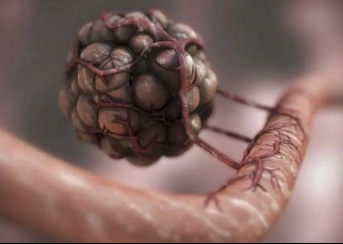 Así es como un tumor crea su propio suministro de sangre-Manchas